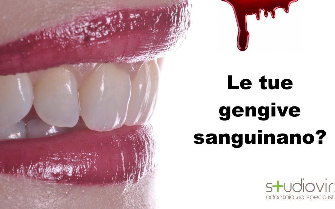 Le Gengive sanguinano? Ecco quello che NON VORRESTI SAPERE.